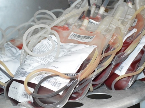 Santa Casa: Banco de Sangue realiza tripla campanha por doadores de sangue, de plaquetas e de medula óssea
