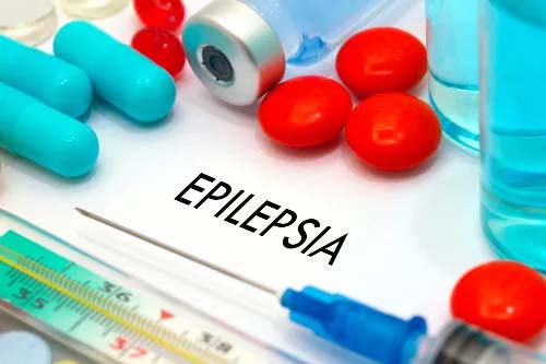 Saiba tudo sobre Epilepsia