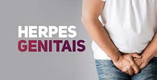 Herpes genital: 1 em cada 5 adultos no mundo tem infecção, diz OMS