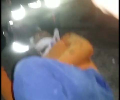 Motociclista atropela jumento e fica ferido na AL 115 em Arapiraca