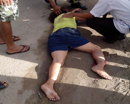 Mulher é atropelada perto do aeroporto de Maceió e tem fratura exposta