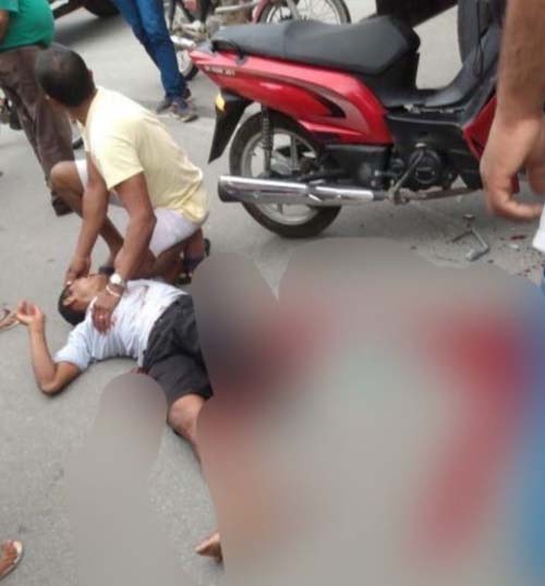 Motociclista tem perna decepada após colisão com caminhão em Murici