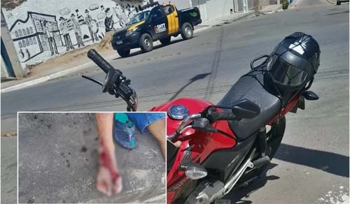Homem em motocicleta embriagado sofre amputação no pé após colisão em São Miguel dos Campos