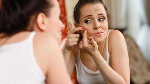 Alerta: Acne pode ser confundida com outras doenças de pele