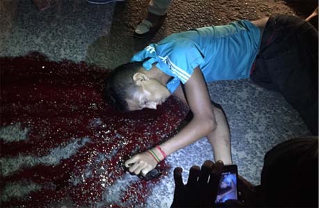 Ladrão de moto morre em acidente de trânsito durante a fuga em Arapiraca