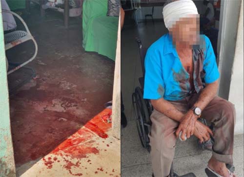 Mulher que agrediu companheiro a facadas sofre com transtornos mentais, diz PC