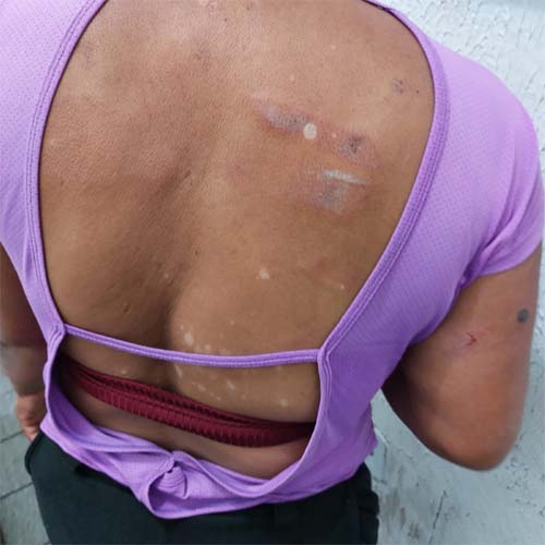 Homem é preso em flagrante por lesão corporal contra a mulher em União dos Palmares