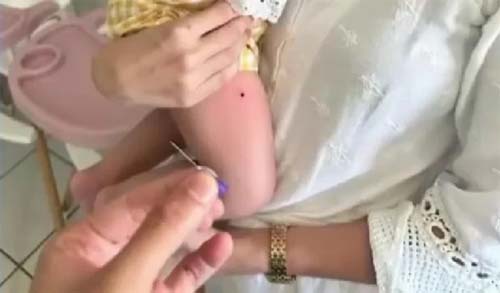 Incidente de negligência em vacinação infantil em Maceió causa preocupação