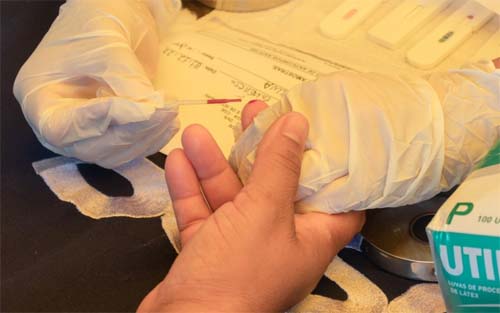 Maceió registra alta no nº de caso de AIDS e HIV entre jovens