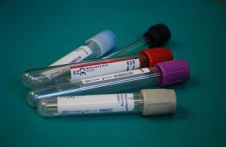 Aids: preconceito dificulta acesso à política preventivas