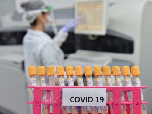 Alagoas registra mais 1.017 casos de Covid-19 e óbitos chegam a 1.486