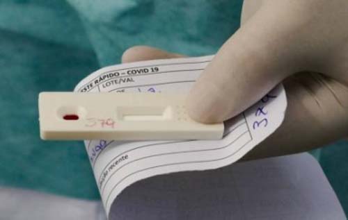 Alagoas ultrapassa a marca de 43 mil casos da Covid-19 e totaliza 1.230 óbitos