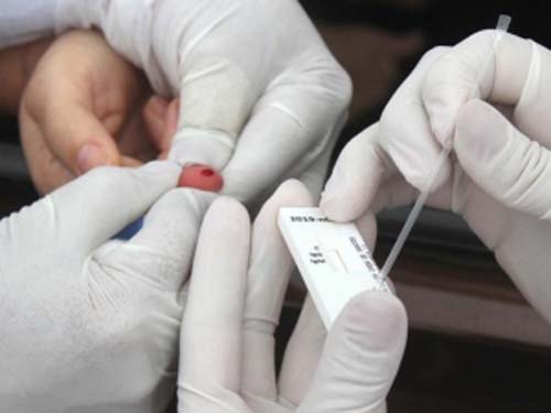 Com mais 11 mortes, Alagoas chega a 1.688 óbitos por Covid-19