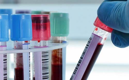 Nas últimas 24 horas Alagoas não registra nenhuma morte por Covid-19