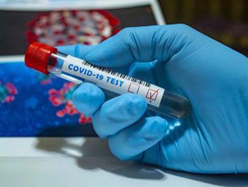 Covid-19: AL registra mais 24 mortes e confirma 789 novos casos da doença