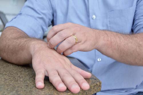 Sesau elabora Linha de Cuidados para Hanseníase