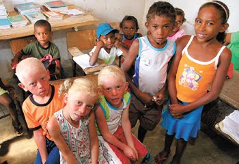 Quilombolas albinos de Santana do Mundaú voltam ao Hospital Universitário de Maceió