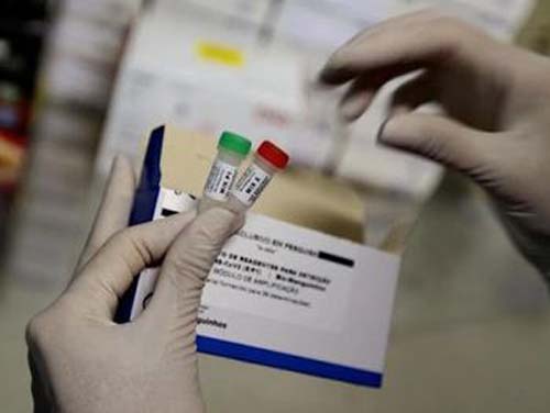 Covid-19: número de mortes cai em Alagoas e mais sete estados