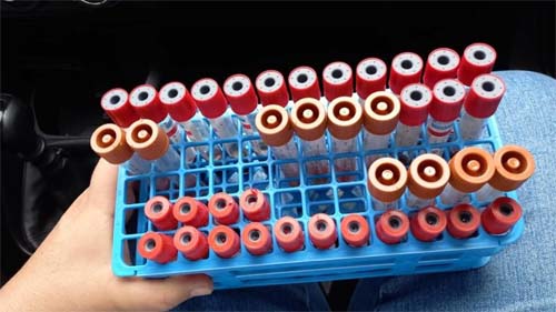 Adeal inicia coleta de amostras para investigar influenza aviária e doença de Newcastle em propriedades de Alagoas