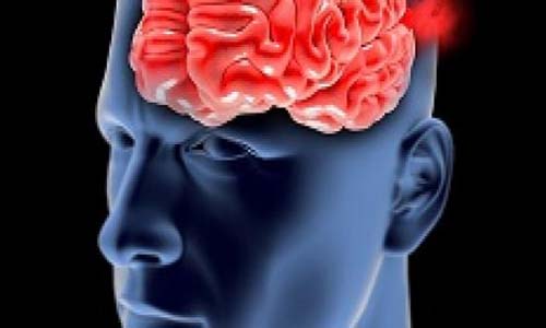 Estudo norte-americano afirma que o cigarro é o principal causador de aneurisma cerebral