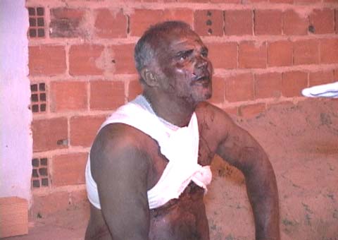 Casal fica ferido após duelo de facas no Clima Bom em Maceió