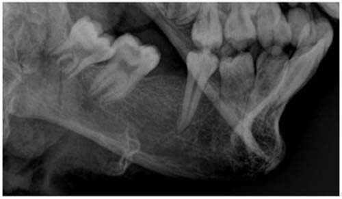 ML identifica corpo encontrado queimado em Arapiraca