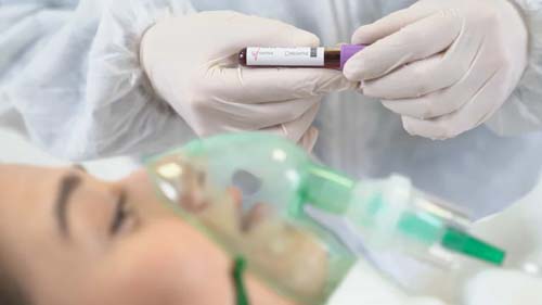 Covid-19: Estudo identifica causas para asfixia impercetível