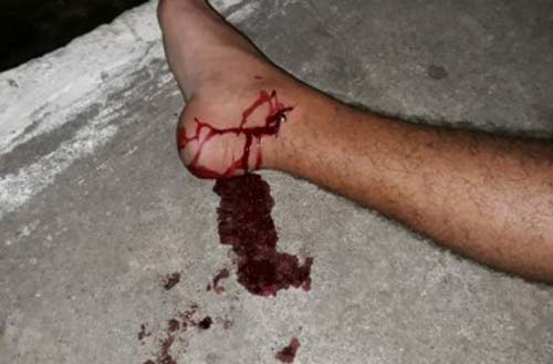 Criminosos assaltam celular e atiram em vítima na Vila Bananeiras, em Arapiraca