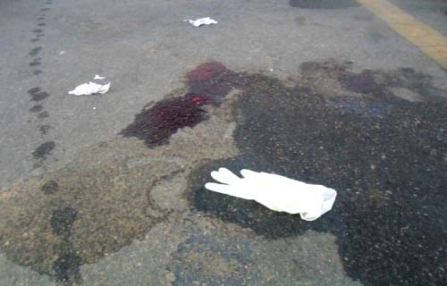 Homem morre e criança de cinco anos fica ferida em atentado no Lago da Perucaba 