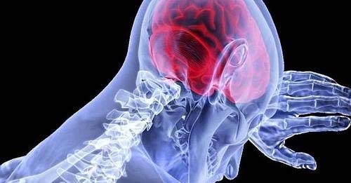 Veja quatro hábitos que você precisa adotar para evitar um AVC