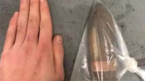 Paciente com bala de canhão no reto obriga hospital a chamar esquadrão antibomba