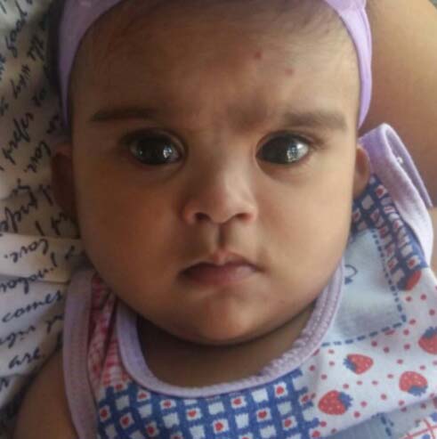 Familia de União dos Palmares faz apelo por ajuda para operar criança de 5 meses em São Paulo