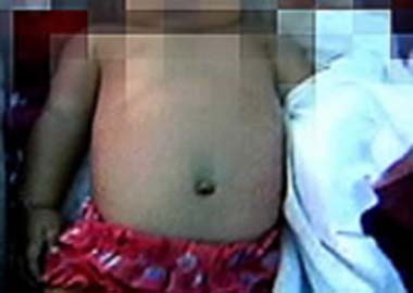 Briga entre casal deixa bebê ferido após ‘vassourada’ 