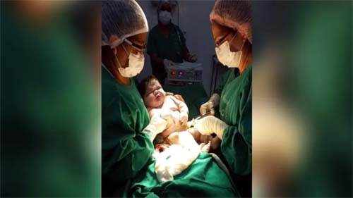 Bebê de 7,3 kg nasce no Amazonas: quais os riscos de dar à luz um filho 'gigante'
