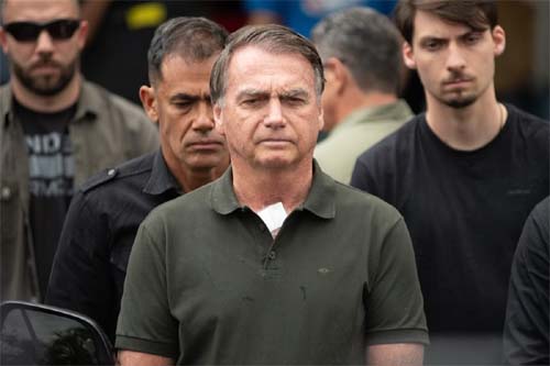 Jair Bolsonaro Pode Ser Liberado da Prisão Domiciliar por Motivos de Saúde: Entenda as Recentes Orientações