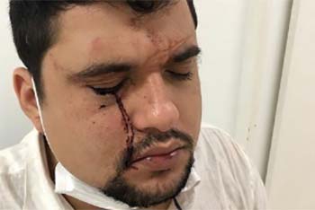 Vítimas denunciam empresário e personal por agressões após show no Jaraguá