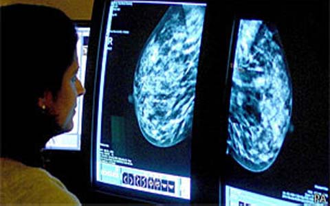 Câncer de mama tem cura quando diagnosticado de forma precoce, alertam mastologistas