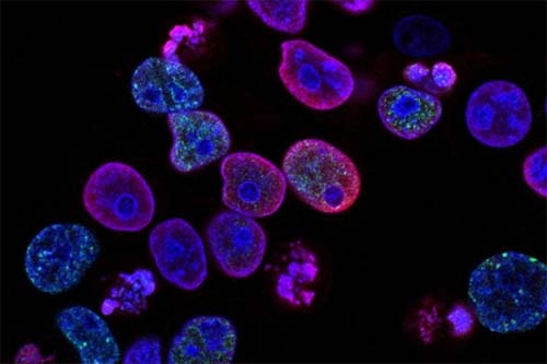 Cientistas estão descobrindo como o câncer se espalha no corpo