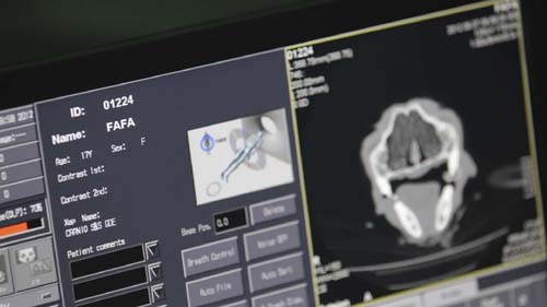 Especialista alerta para sintomas do câncer de ovário