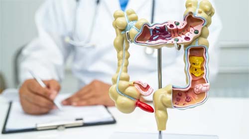 Consumo de Vegetais Crucíferos Reduz em 20% o Risco de Câncer Intestinal, Revela Pesquisa