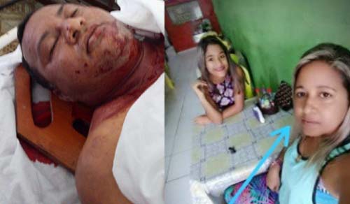 Homem e mulher são mortos a tiros, em Chã do Pilar