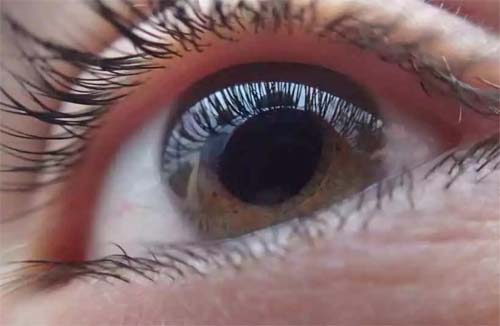 Catarata atinge 25% dos brasileiros com mais de 50 anos, aponta pesquisa