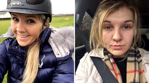 'Meus selfies contam minha história com a depressão'