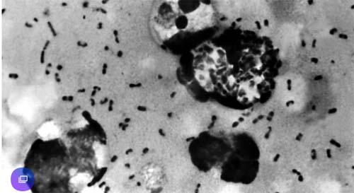 Caso de peste bubônica faz China elevar estado de alerta no norte do país