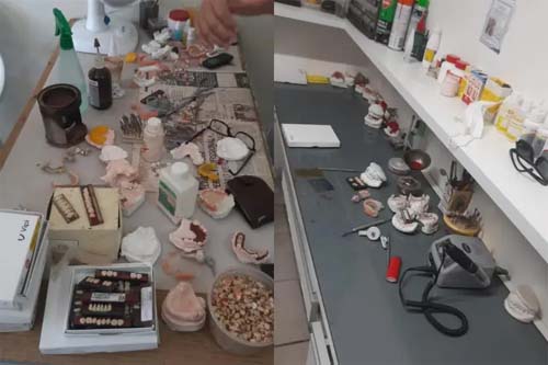 Fiscalização do CRO-AL Descobre Práticas Ilegais em Clínicas de Prótese no Bairro Benedito Bentes