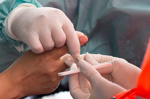 Teste que será aplicado em 33 mil brasileiros terá respostas limitadas sobre coronavírus