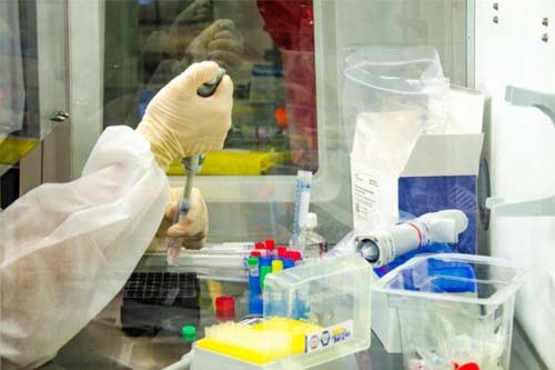 Mundo supera 1,2 milhão de mortes provocadas pelo coronavírus