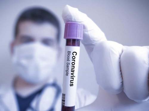 Alagoas tem a segunda maior taxa de transmissão de Covid-19 do Nordeste