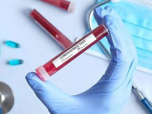 Covid-19: Alagoas tem mais de 4 mil casos confirmados e número de óbitos sobe para 221