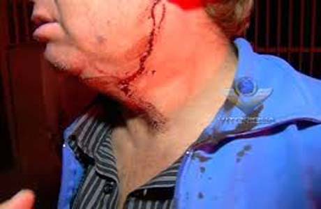 Idoso se nega a ter relações sexuais e é agredido com estilete
